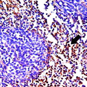 Mouse Breast Cancer, CD8, IHC