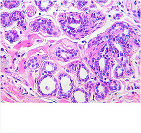 Routine & Special Staining