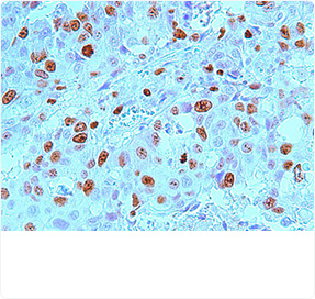 IHC & IF Staining