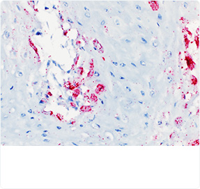 In Situ Hybridization (ISH)