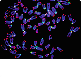 Chromosome Analysis