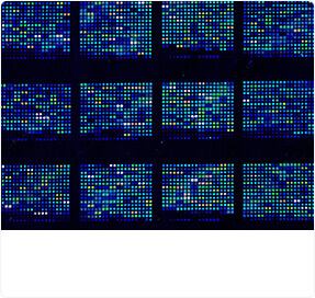 DNA Microarrays