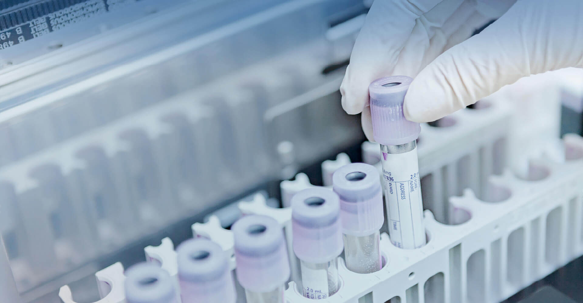Diverse Biospecimen Resources