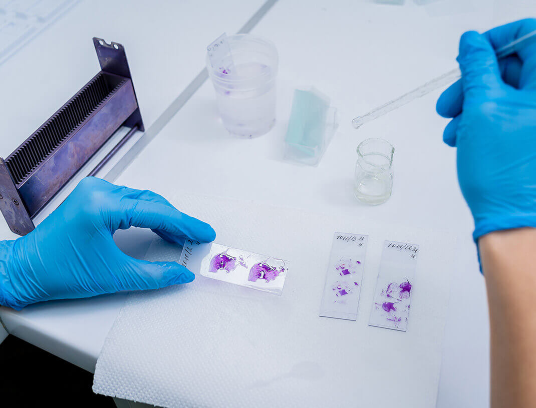 Immunohistochemistry