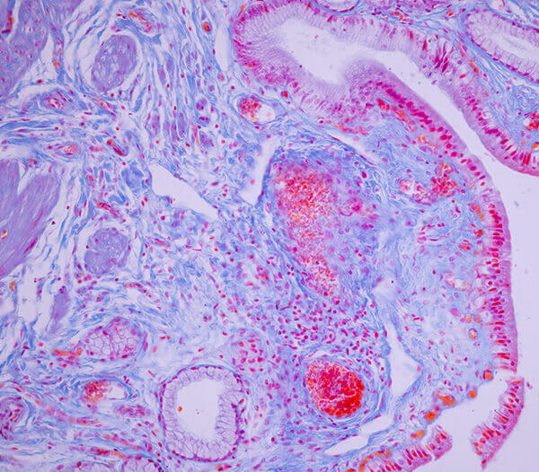 Neuropathology