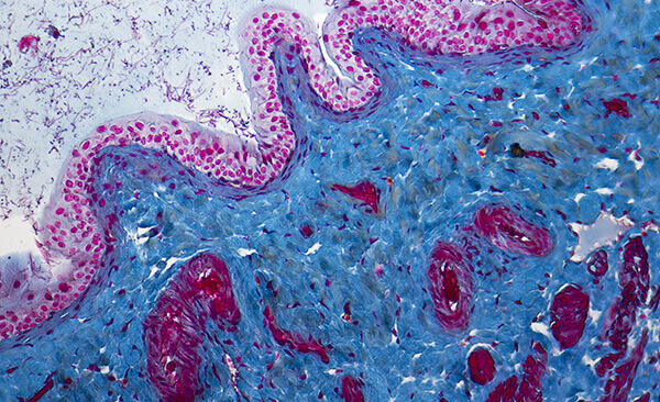Musculoskeletal Pathology Services