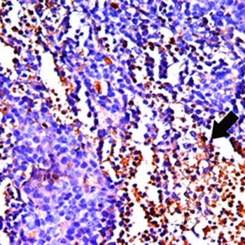 Mouse Breast Cancer, CD4, IHC