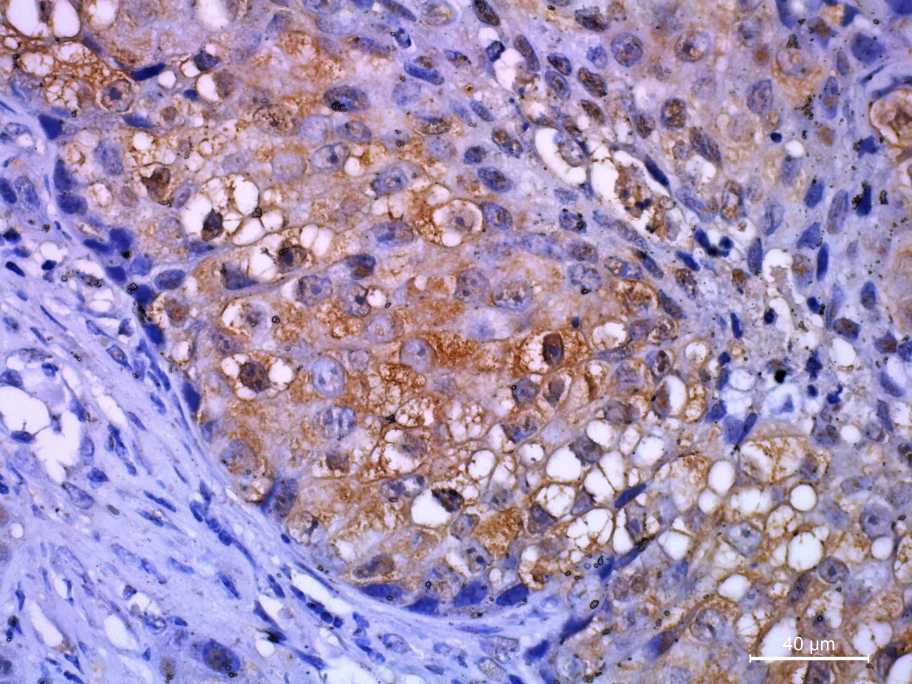 Considerations for IHC Staining?