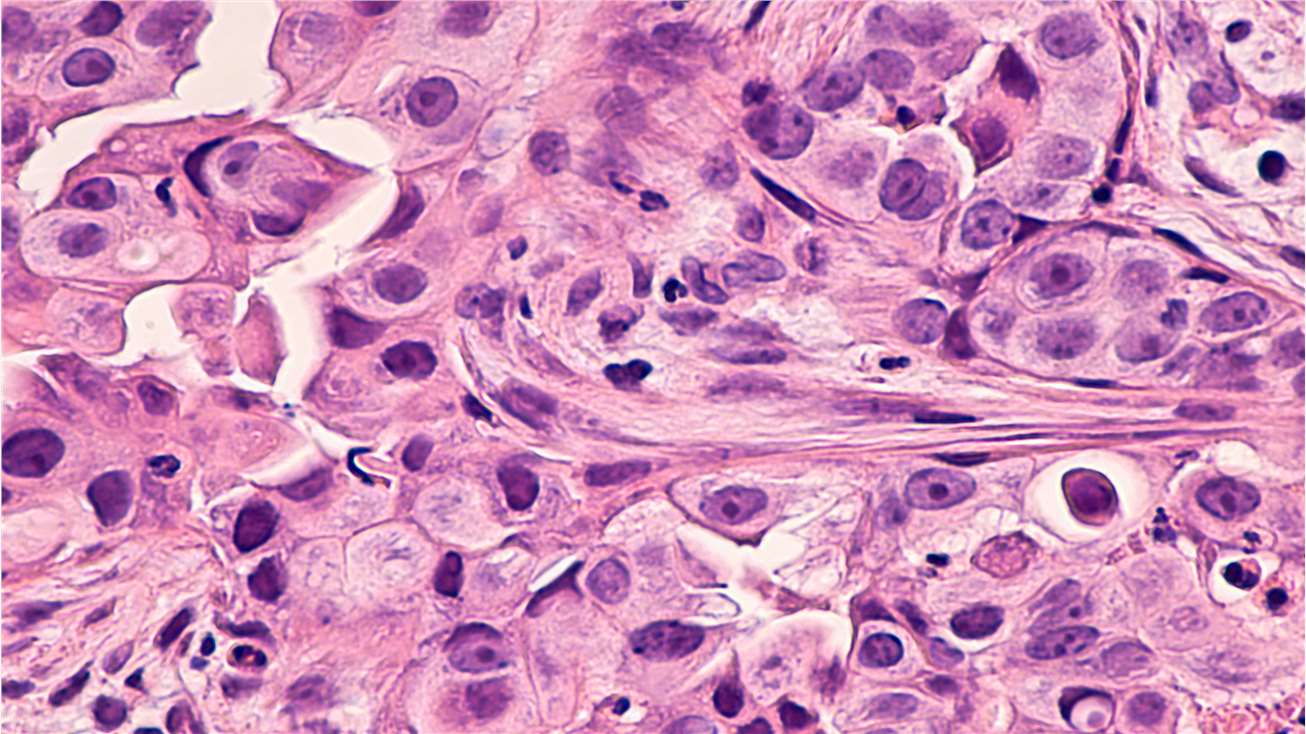 What is H&E Staining?