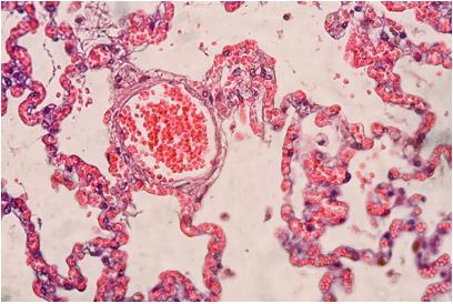 H and E Staining Troubleshooting