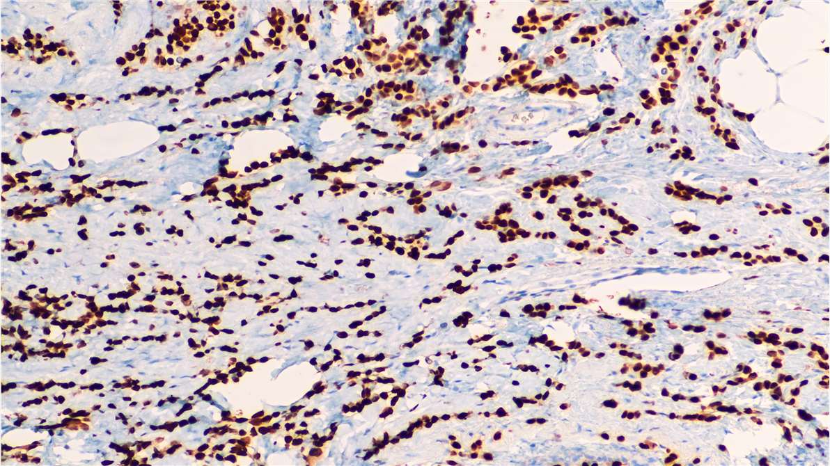 An Overview of Immunohistochemistry Staining