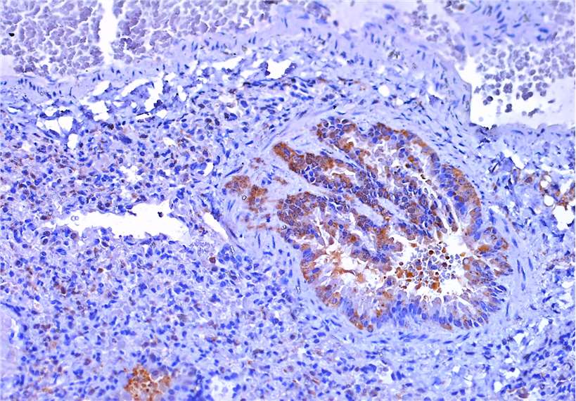 IHC Troubleshooting