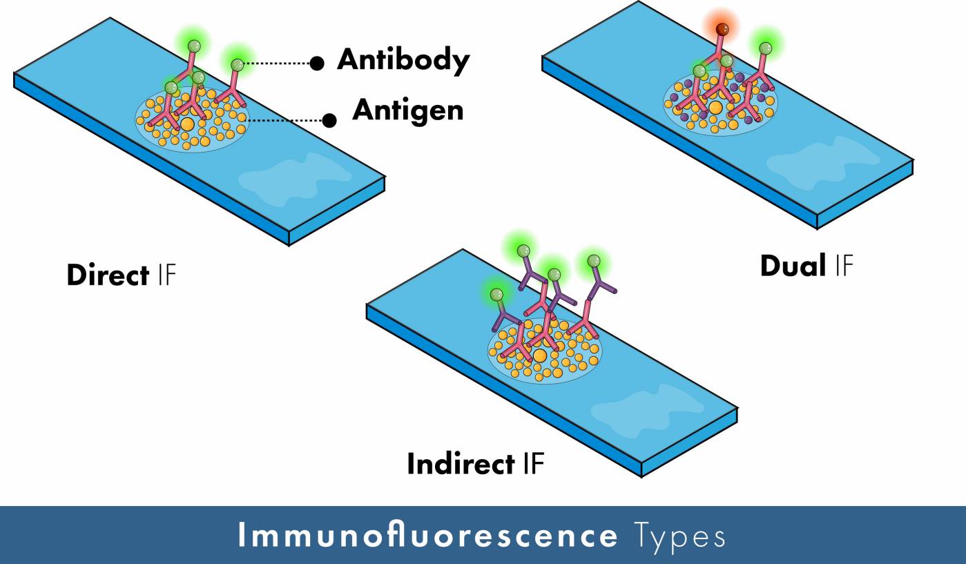 FISH: Fluorescence in situ Hybridization