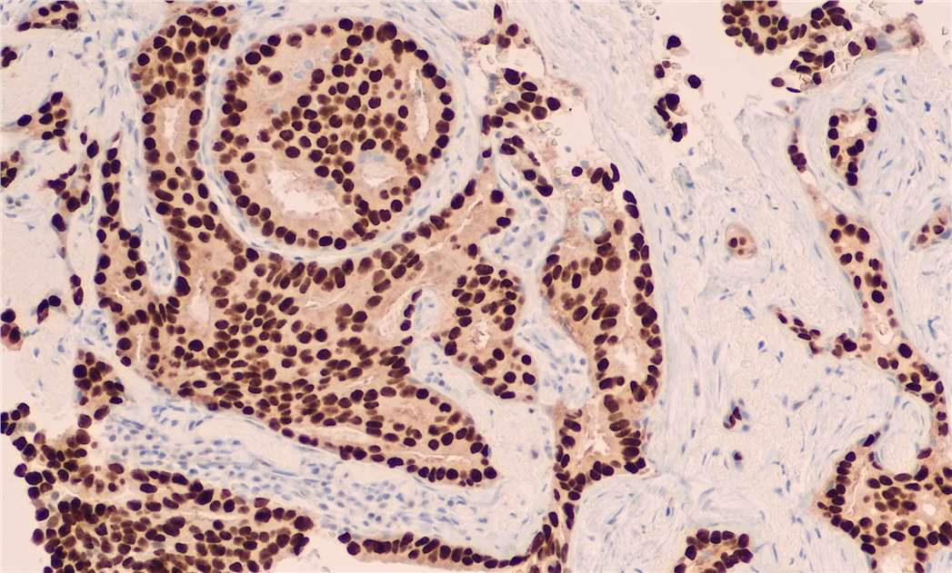 Tips for Better Immunohistochemistry (IHC)