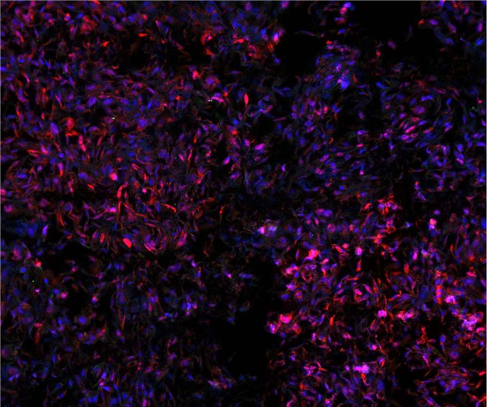 Considerations for Immunofluorescence Staining