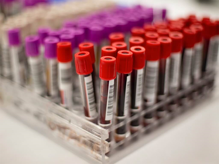 Blood Samples