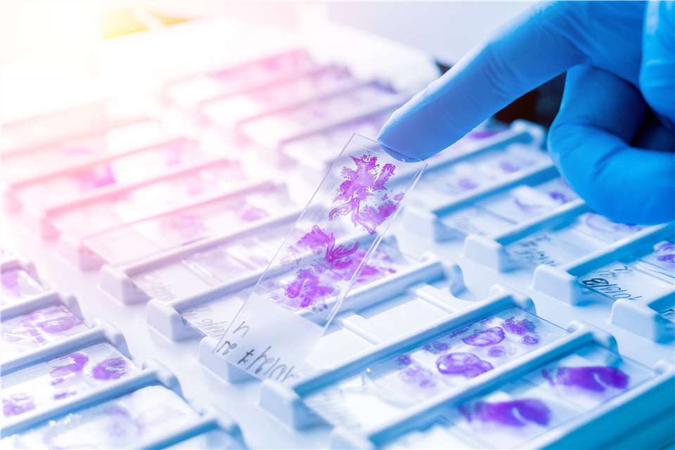 What is FFPE Tissue?
