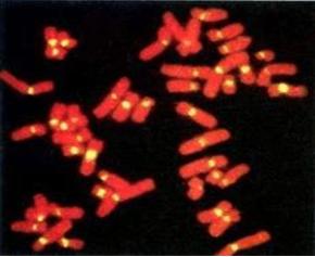 Tips For Better Fluorescence In Situ Hybridization (FISH)